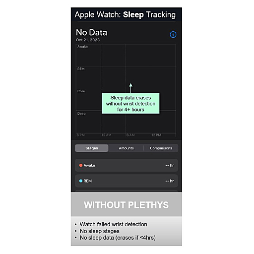 Apple watch results and failures from not using the Plethys product