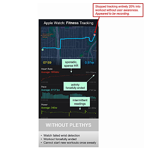 Apple watch results and failures from not using the Plethys product